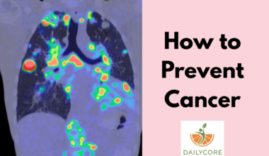 Increase Antioxidant Intake
