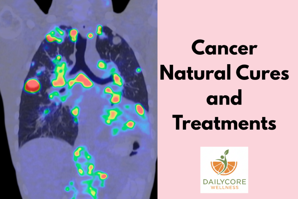 Cancer Natural Cures and Treatments